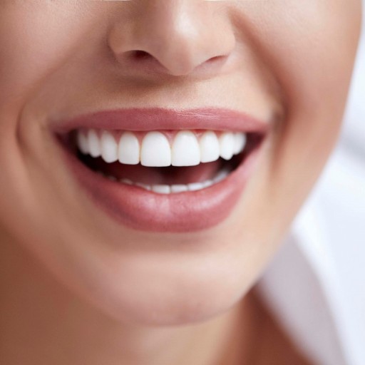 4 kroky jak efektivně zabránit zubnímu kazu